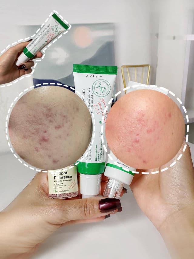 AXIS-Y Dark Spot Correcting Glow Serum review photo by itscrissel