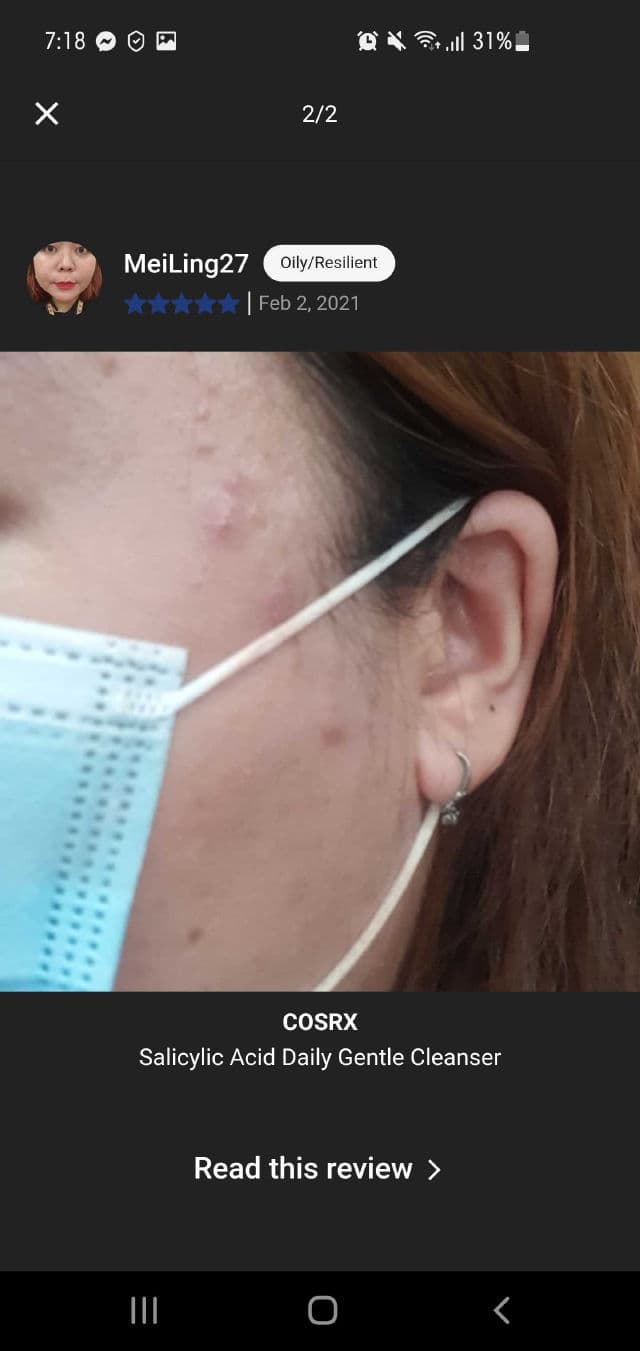 The Ordinary Retinol 0.5% in Squalane review photo by MeiLing27