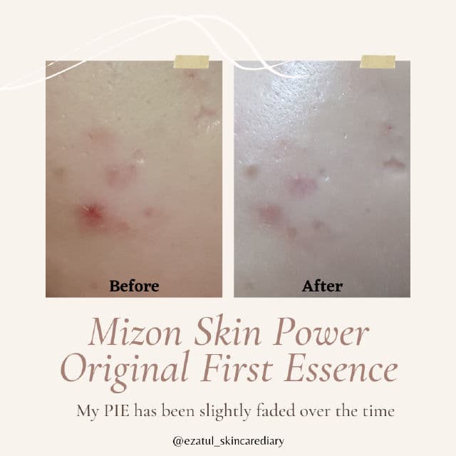 Mizon Skin Power Original First Essence review photo by ezatulSkincareDiary