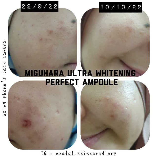 Miguhara Ultra Whitening Ampoule review photo by ezatulSkincareDiary