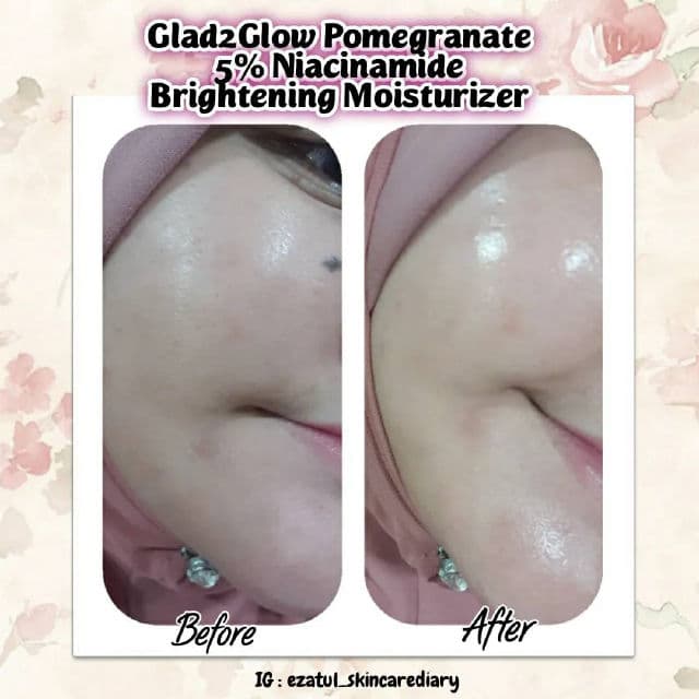 Glad2Glow Pomegranate 5% Niacinamide Brightening Moisturizer review photo by ezatulSkincareDiary