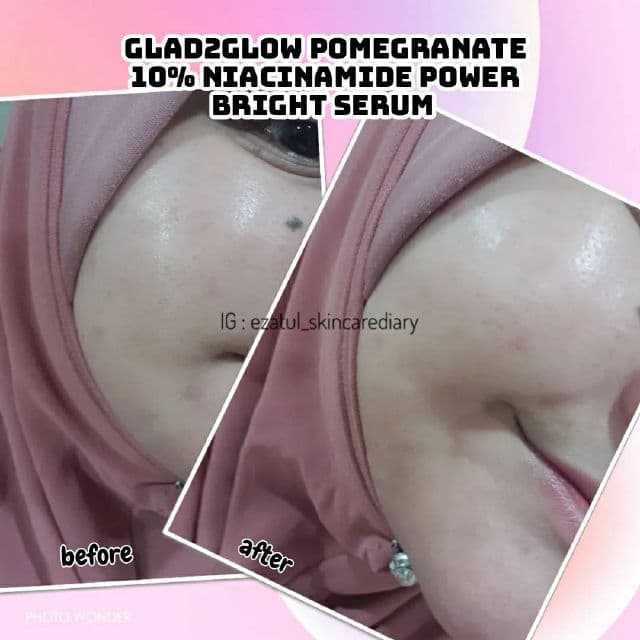 Glad2Glow Pomegranate 10% Niacinamide Power Bright Serum review photo by ezatulSkincareDiary