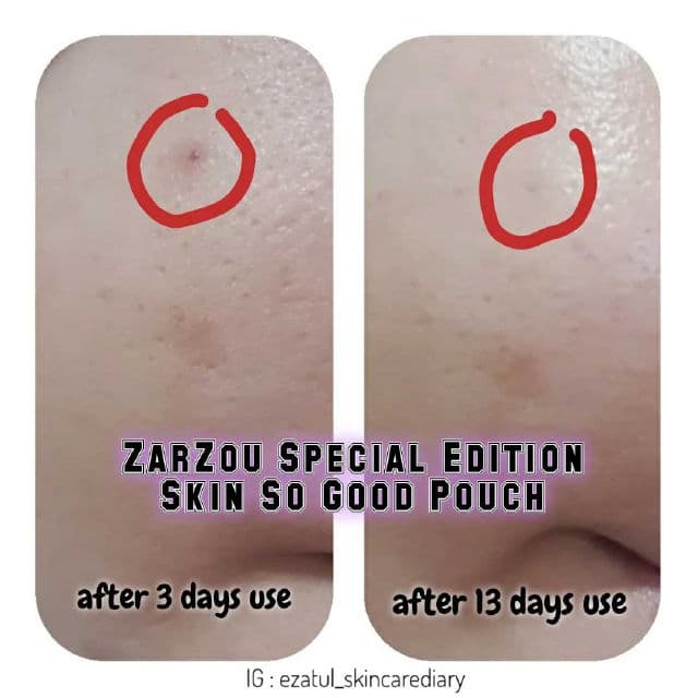 ZarZou Beauty Brightening & Hydrating Facial Serum review photo by ezatulSkincareDiary