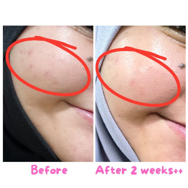 Kayman Beauty Rosa Glow Treatment Essence review photo by ezatulSkincareDiary
