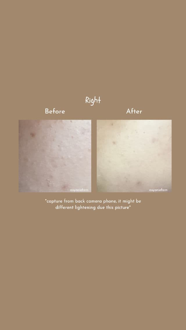 REP Bio Fresh Mask with Real Nutrition Herbs review photo by asyanie