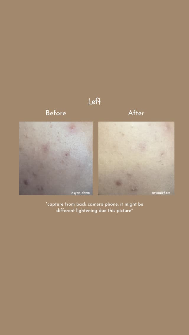 REP Bio Fresh Mask with Real Nutrition Herbs review photo by asyanie