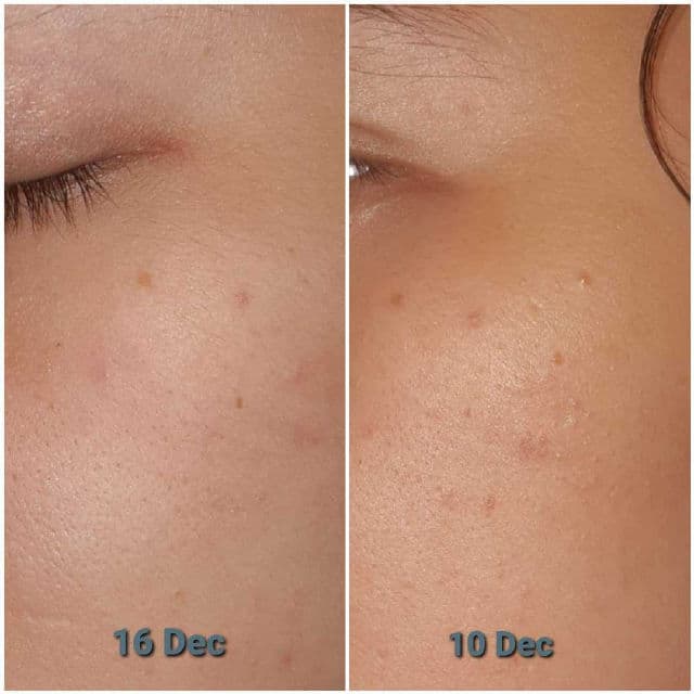 Vitamin E Calming Light Cream product review