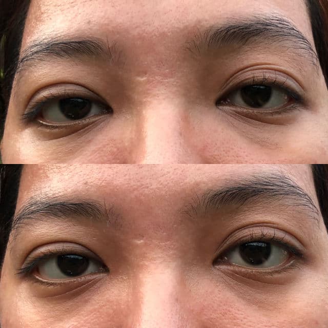 The Originote Eye Serum review photo by marini