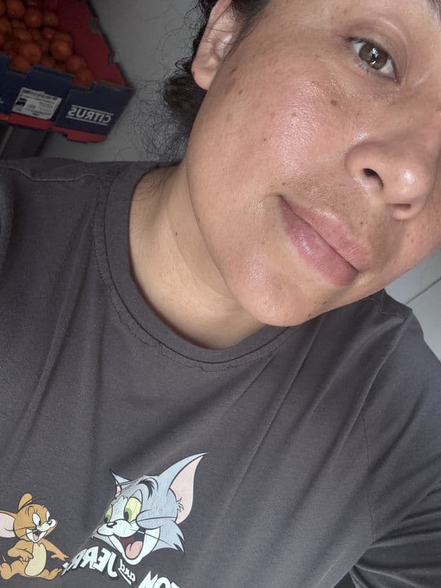 Dr.Melaxin TX Cream Plus review photo by july1
