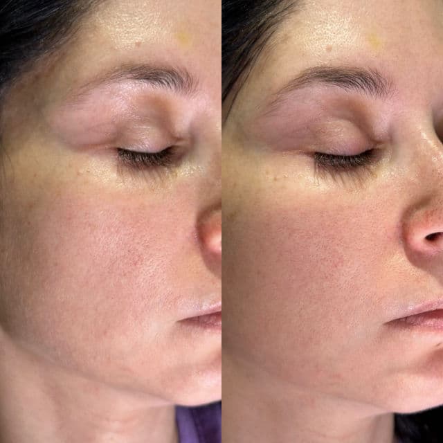 Indeed Laboratories Nanoblur - Instant Skin-Blurring Cream review photo by pris9