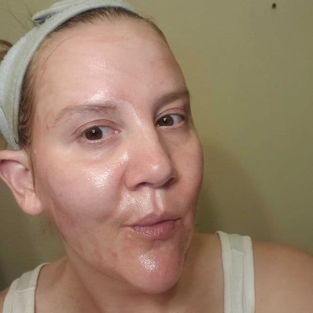 ZOMBIE BEAUTY by SKIN1004 Bloody Peel product review
