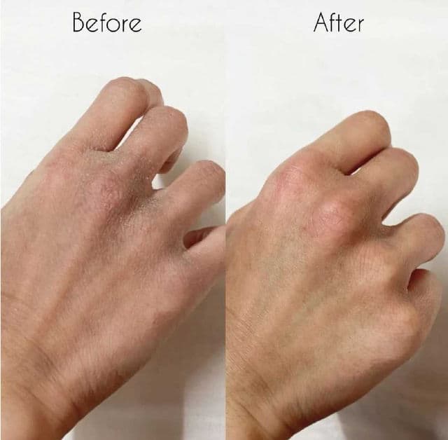 Zeroid Richenic Cream Urea 5% review photo by MLiaBeauty