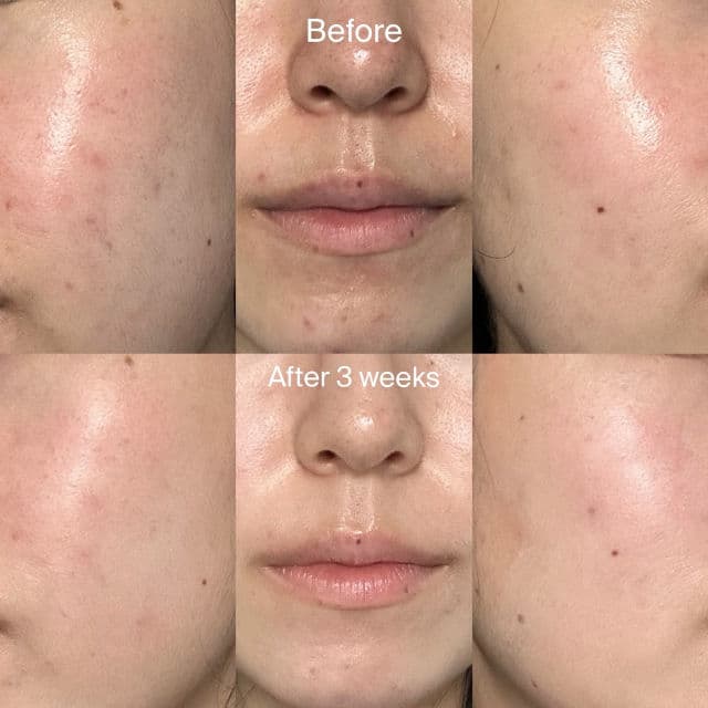 Dr. Ceuracle Pure VC Mellight Boosting Essence review photo by NatalieP