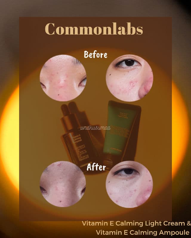 COMMONLABS Vitamin E Calming Light Cream review photo by Kusuma
