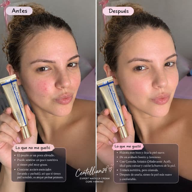 Centellian24 Expert Madeca Cream Core Voluming review photo by JCapote