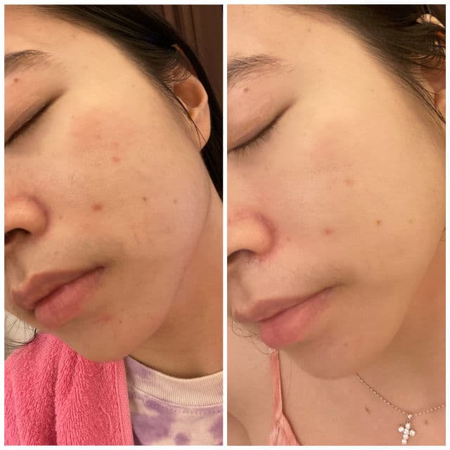 Glowlabs Glo-C Serum (Brightening Vitamin C Serum) review photo by celineysphn