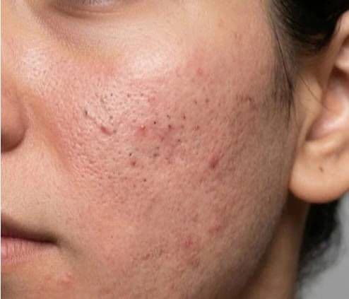 PAPA RECIPE Niacinamide PDRN Brightening Tone-Up Dual-Phase Mist review photo by Asmit