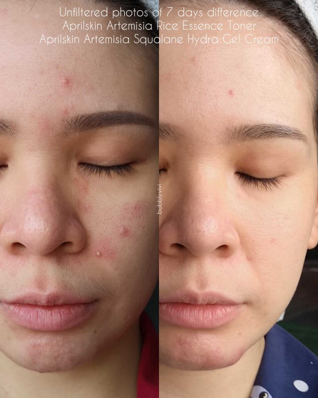 APRIL SKIN Artemisia Rice Toner review photo by bubblyvivi