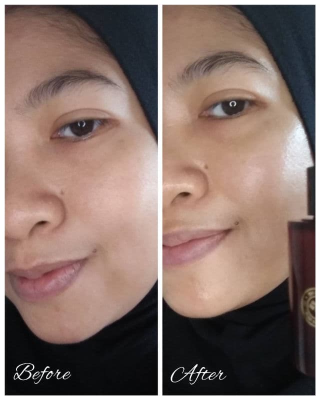 ACWELL Licorice pH Balancing Advance Serum review photo by ecand