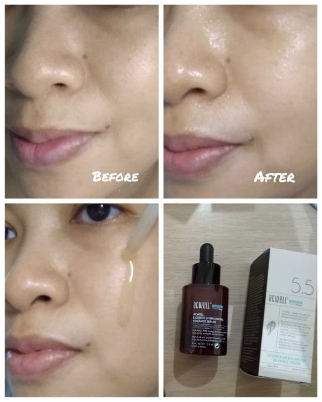 ACWELL Licorice pH Balancing Advance Serum review photo by ecand
