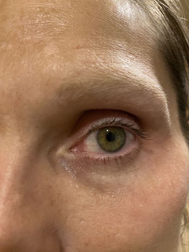 Dr. Zenovia Retinol Recovery Eye Cream review photo by shalynamber