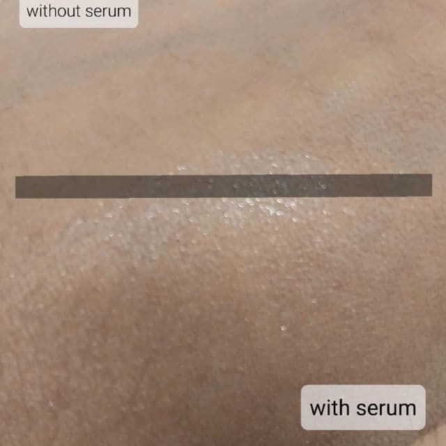 ACWELL Licorice pH Balancing Advance Serum review photo by Remisskin