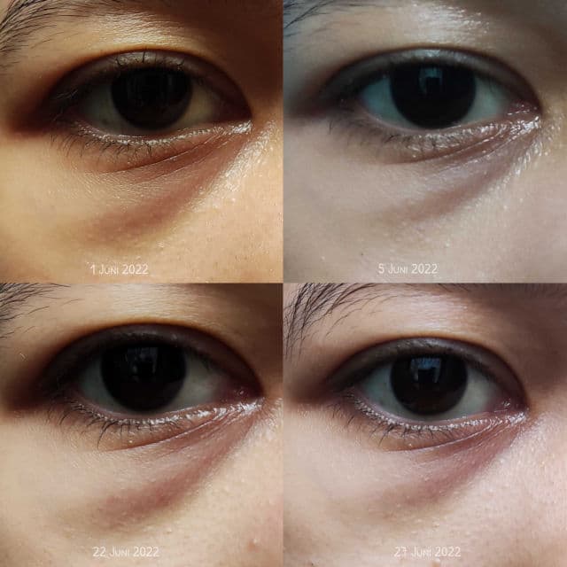 Heimish Bulgarian Rose Water Hydrogel Eye Patch review photo by itsluvina