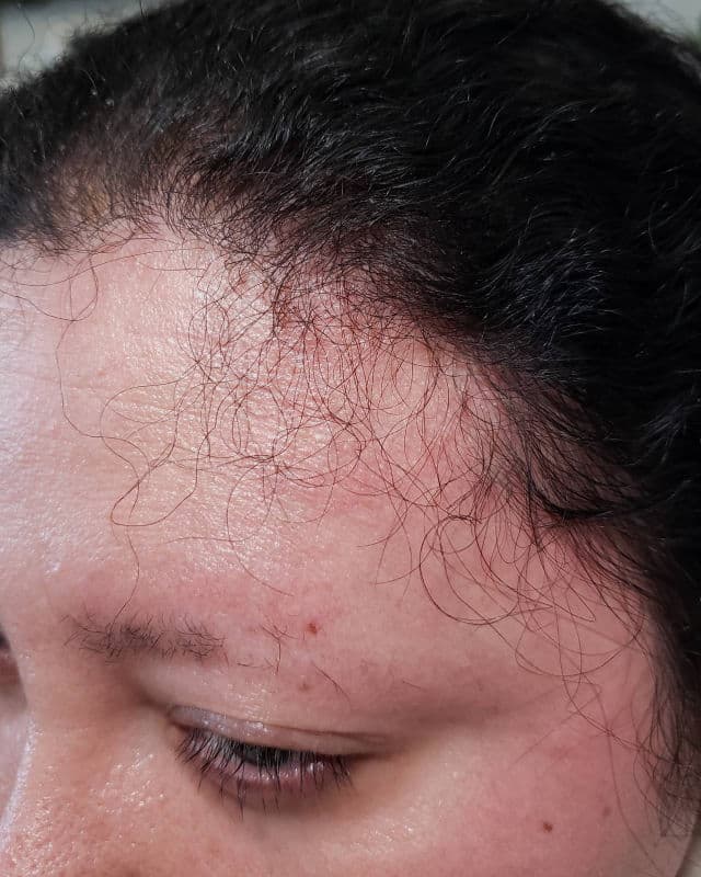 Dr.FORHAIR Folligen Original Tonic review photo by AlottaxReviews