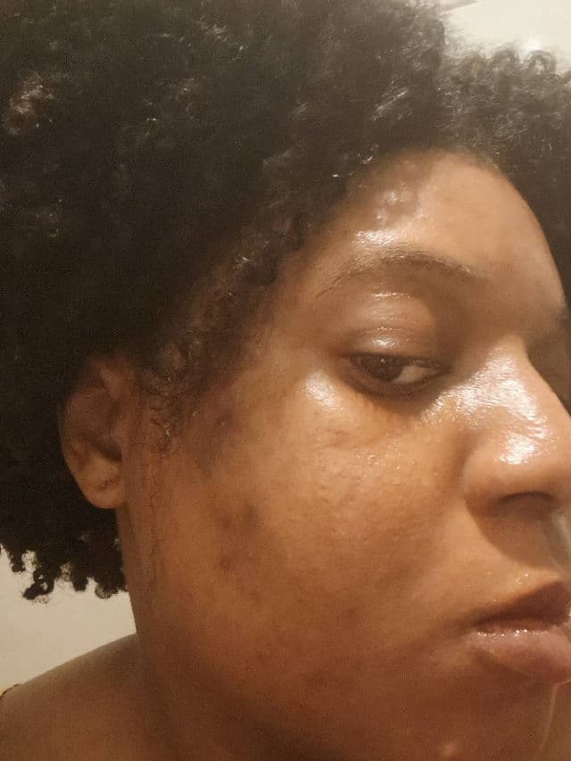 Niacinamide 10% + TXA 4% Dark Spot Correcting Serum product review