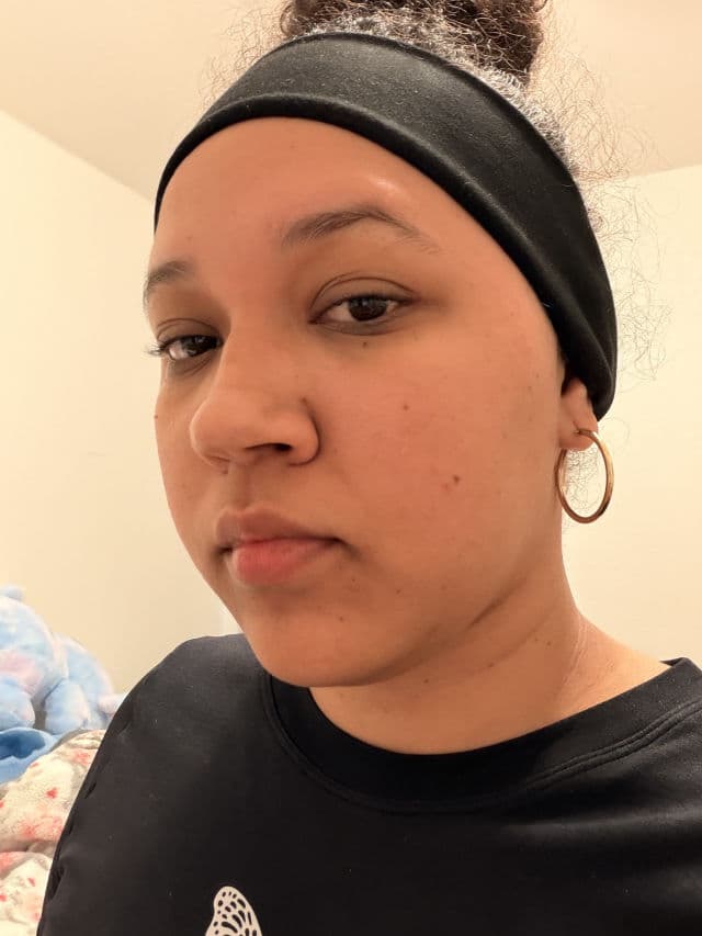 Dr. Deep Mineral Free-Peeling Glow Shot 1500 review photo by yoselaine
