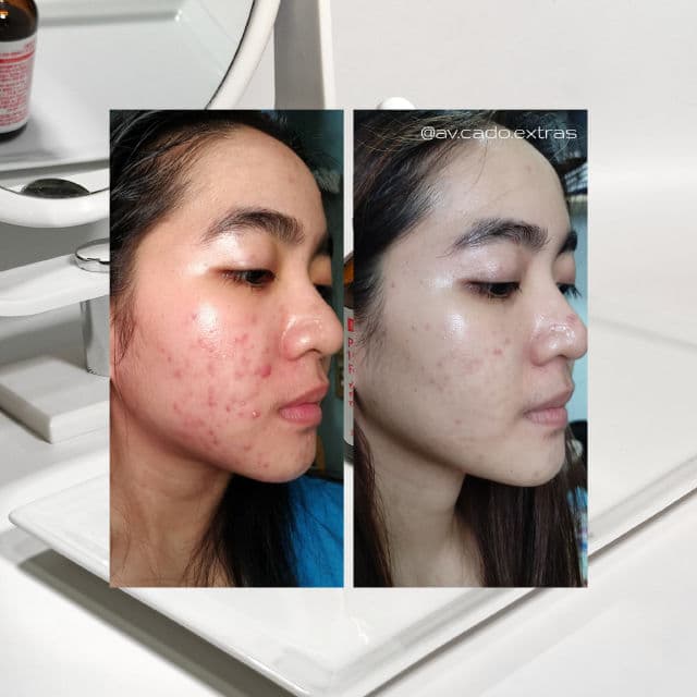 By WISHTREND [Discontinued] Pure Vitamin C 15% with Ferulic Acid review photo by AVCado