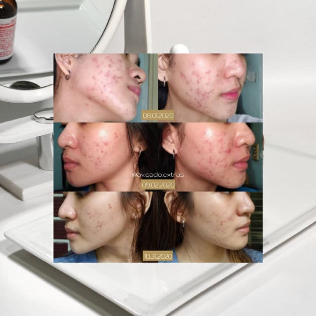 By WISHTREND [Discontinued] Pure Vitamin C 15% with Ferulic Acid review photo by AVCado