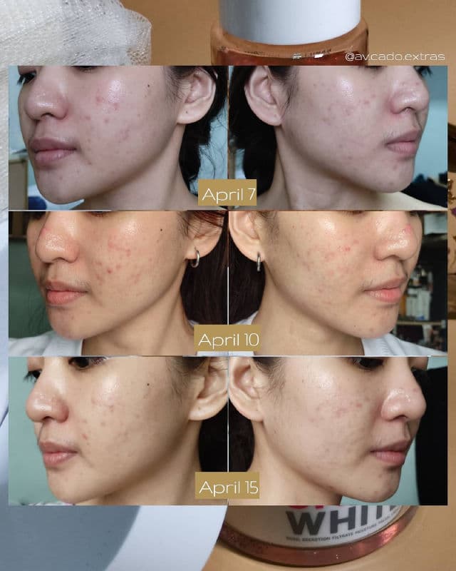 Snail White Snail Secretion Filtrate Moisture Facial Cream review photo by AVCado