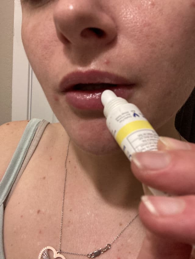 Supergoop! Acai Fusion Lip Balm with Shea Butter Broad Spectrum SPF 30 review photo by AllSkinIsBeauty