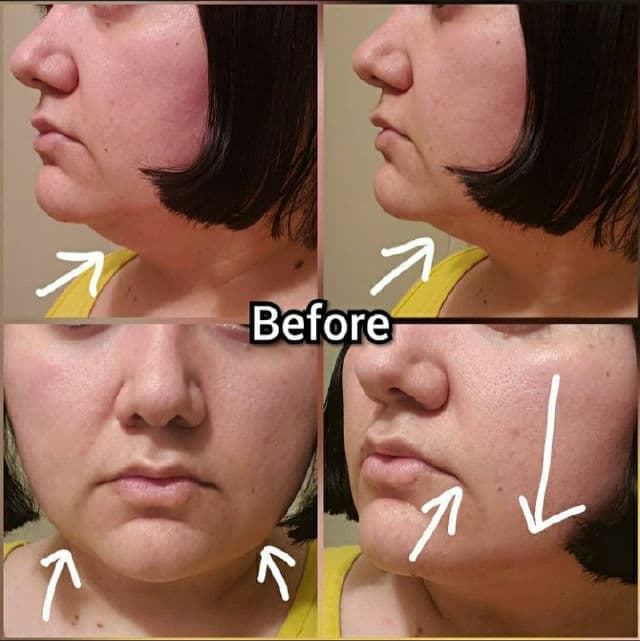 Avajar Perfect V Lifting Premium Mask review photo by AlottaReviews