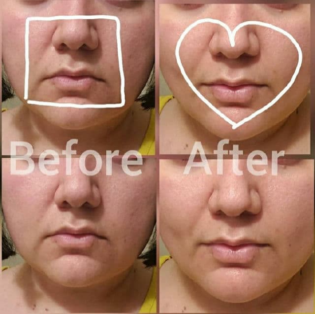 Avajar Perfect V Lifting Premium Mask review photo by AlottaReviews