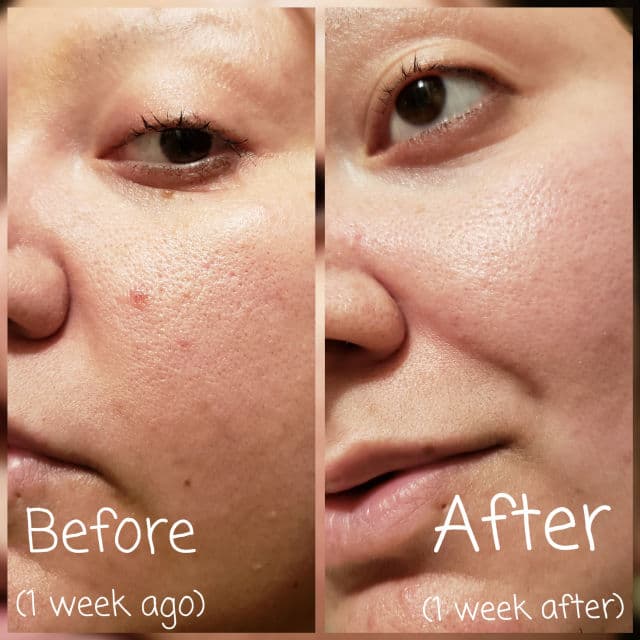 Urban Skin Rx Even Tone Cleansing Bar review photo by AlottaReviews