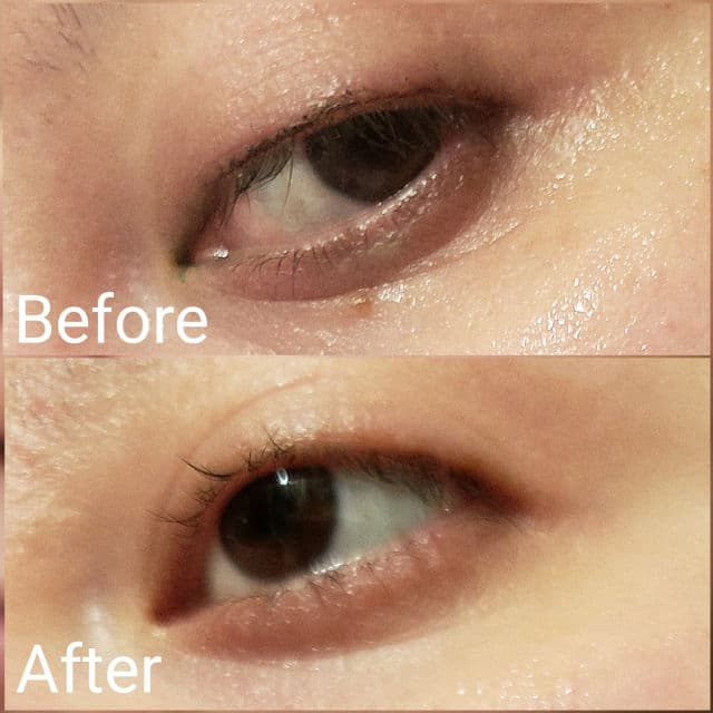 StriVectin Wrinkle Recode Line Transforming Melting Serum review photo by AlottaReviews