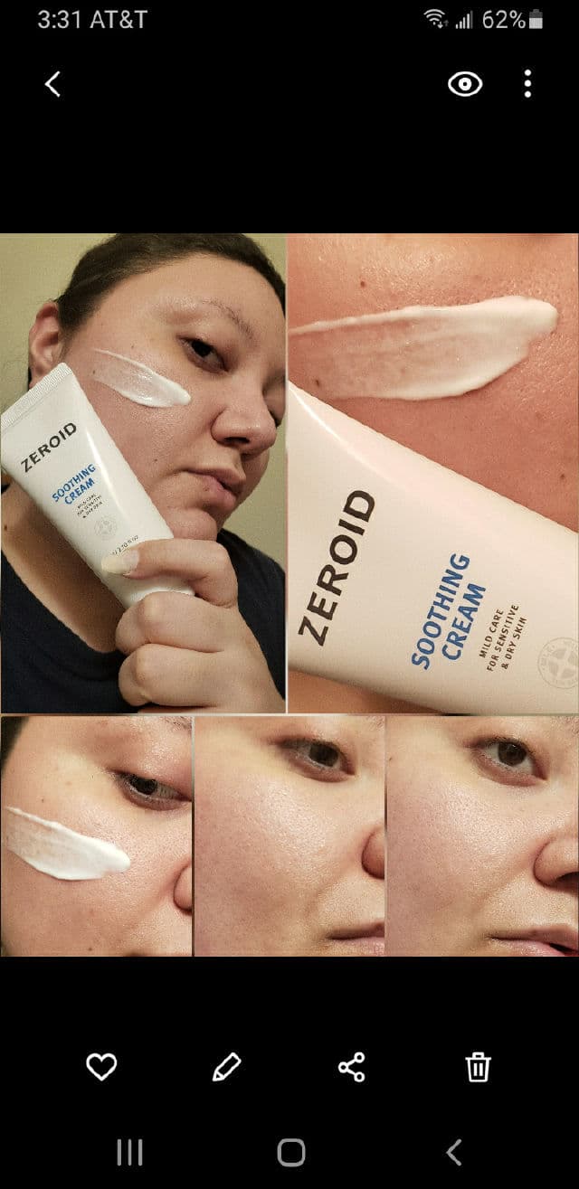 Zeroid Soothing Cream review photo by AlottaReviews