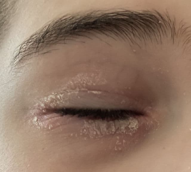 Bioderma Atoderm Intensive Baume review photo by Anastasiya