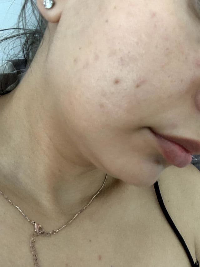 Sesderma Sesvitamin-C review photo by Andrrea