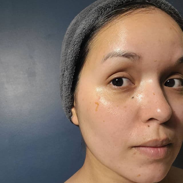 Then I Met You Rosè Resurfacing Facial Mask review photo by BonnieJean