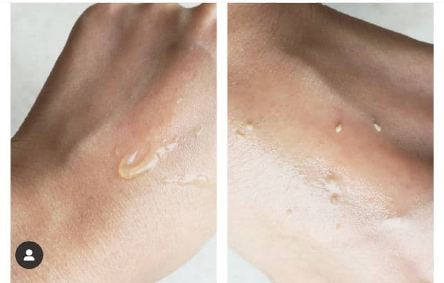 SUR.MEDIC Deep Clear Bright Calming Peeling Gel review photo by Buhbles