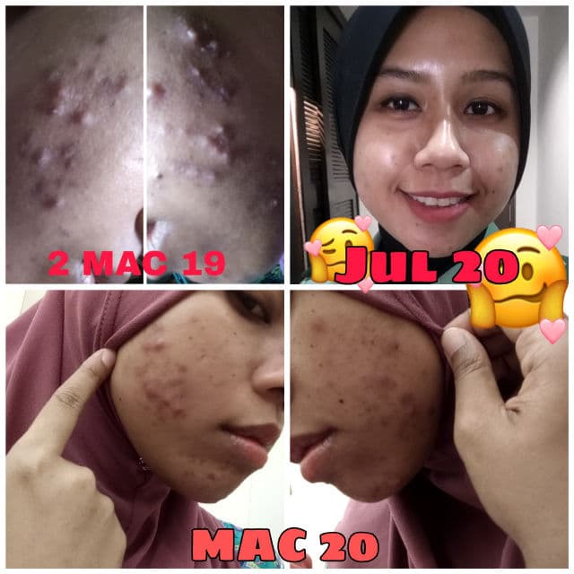COSRX Salicylic Acid Daily Gentle Cleanser review photo by DahliaAtikah