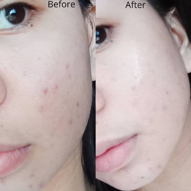 Some By Mi Super Matcha Pore Tightening Serum review photo by Dannybelless