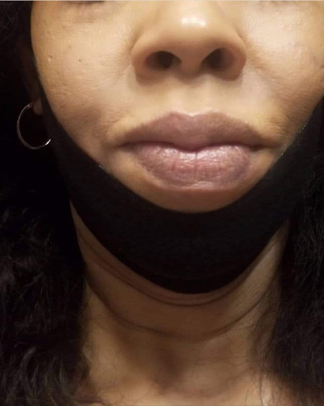 Avajar Perfect V Lifting Premium Black Mask 1 Sheet review photo by Deedee1