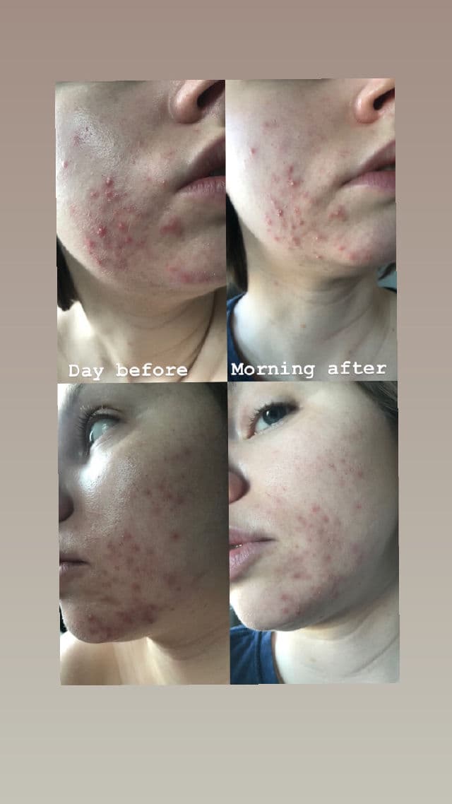 Beauty Bay Soothe Paste Blemish Treatment review photo by Duelly