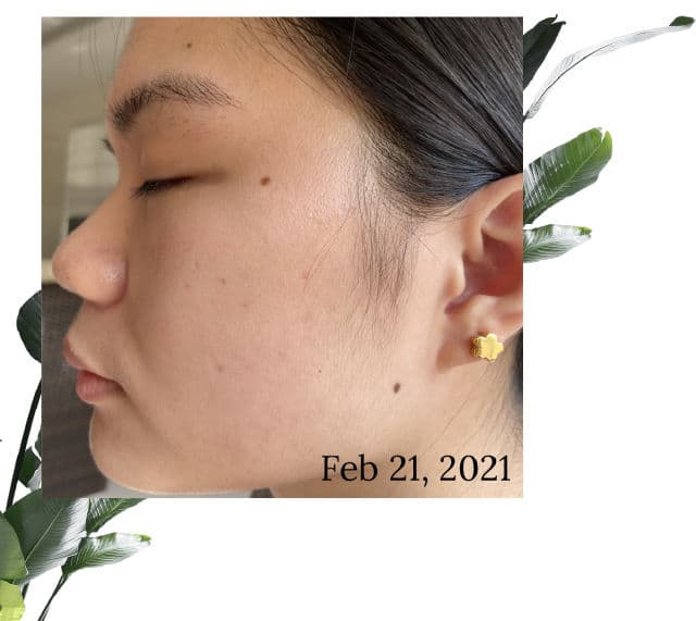 Centella Unscented Recovery Cream product review