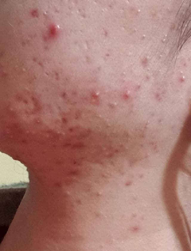 Thayers Alcohol-Free Rose Petal Witch Hazel Toner review photo by EllieGurl