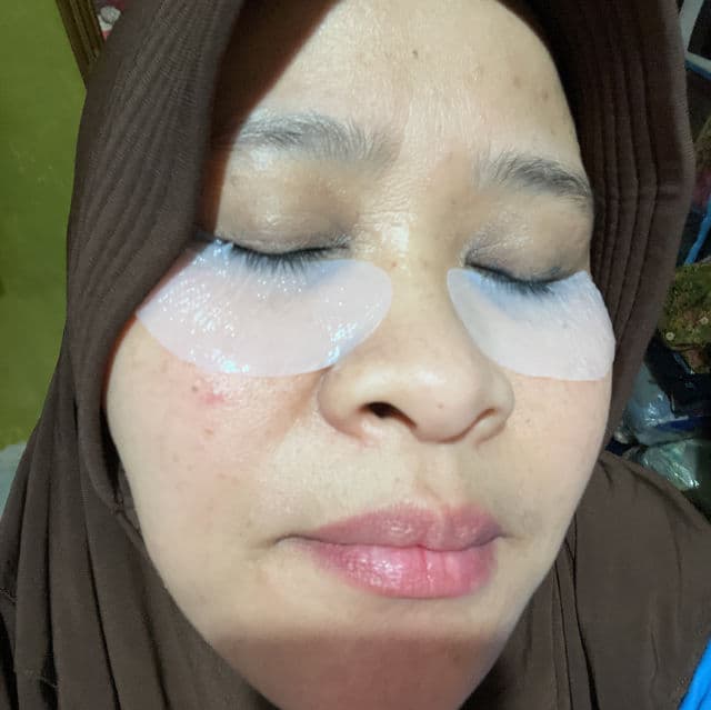 ETUDE Collagen Eye Patch review photo by EyeNez